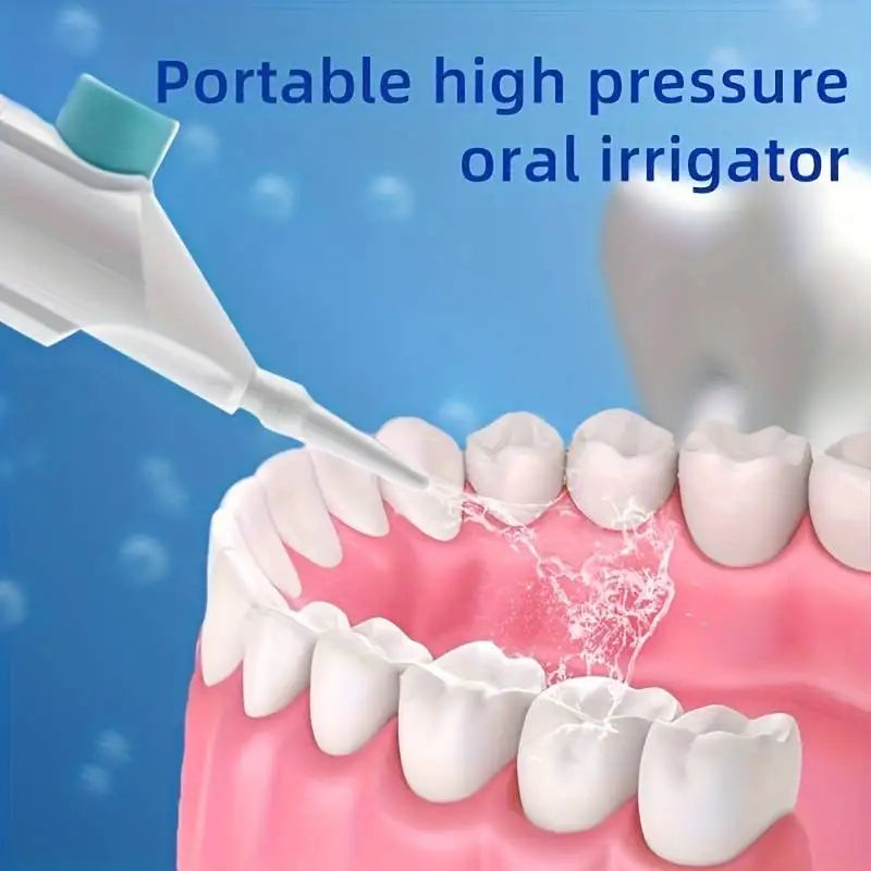 AquaBlast Manual Oral Irrigator